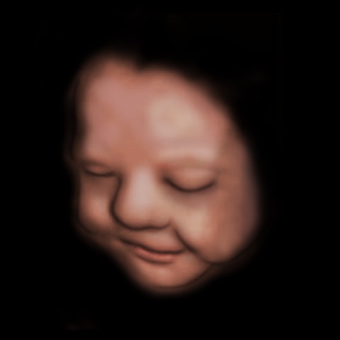 The Baby Connection - 3D 4D HDlive (5D) Ultrasound Roseville Sacramento